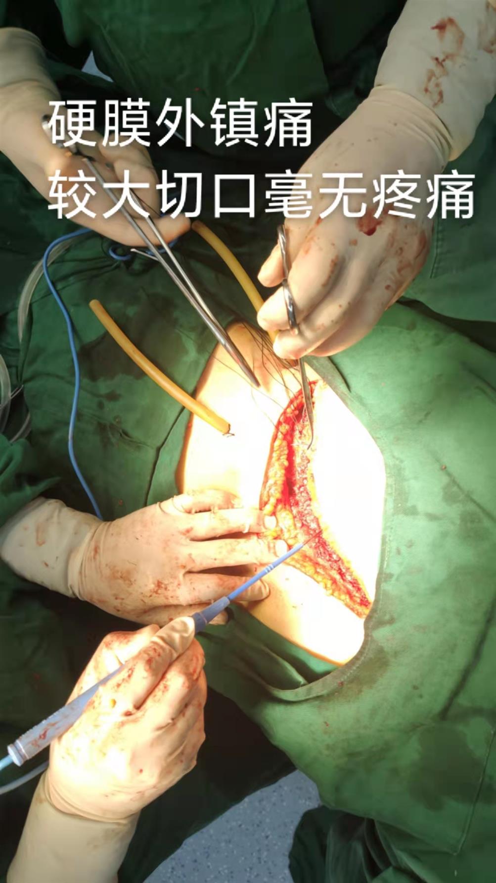 c96644cec886fd105ebd47bd19a816c.jpg c96644cec886fd105ebd47bd19a816c.jpg
